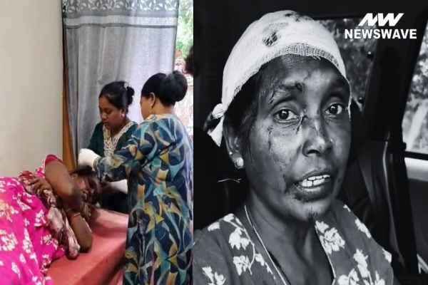 Woman brutally attacked