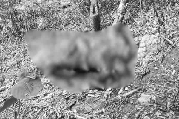 woman's partially burnt body
